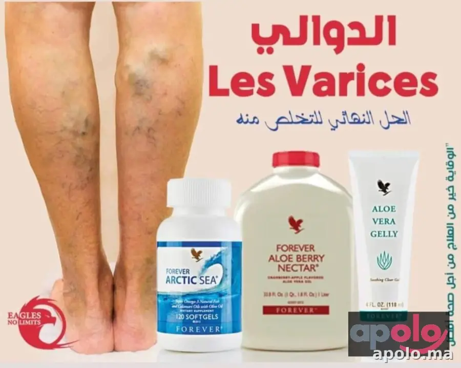 Les Varices